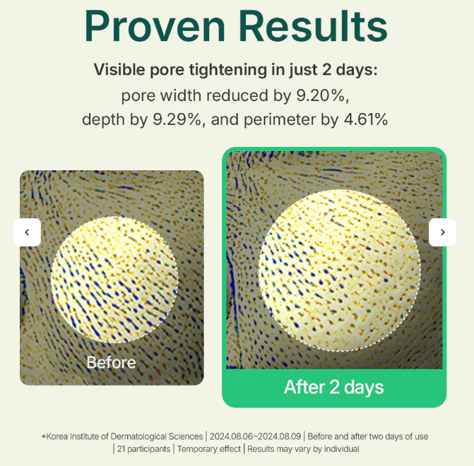 Pó para Tratamento da Acne com Tea Tree Madeca – 6 g